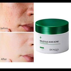 ماسک ضد جوش