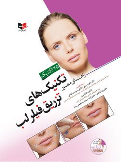 راهنمای مصور تکنیک های تزریق فیلر لب